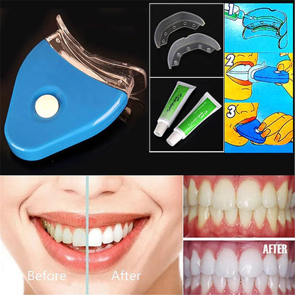 Professional LED Teeth Whitening Kit — Whiter Smile in Days