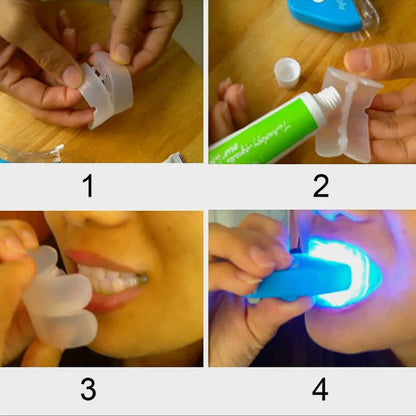 Professional LED Teeth Whitening Kit — Whiter Smile in Days